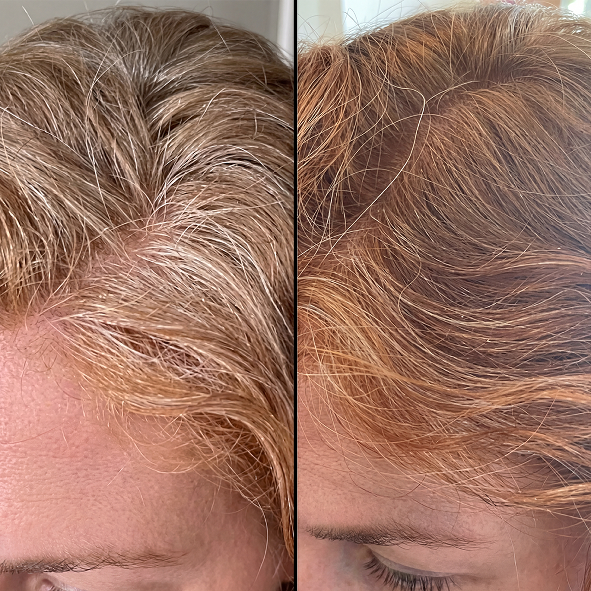 Help reverse premature grey hair and support stronger growth