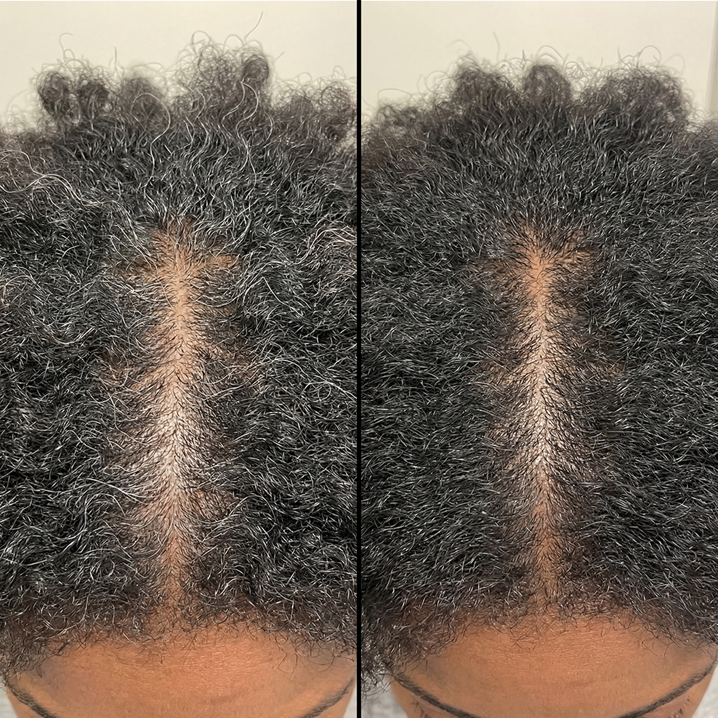 Help reverse premature grey hair and support stronger growth